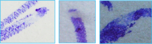 Empastamientos